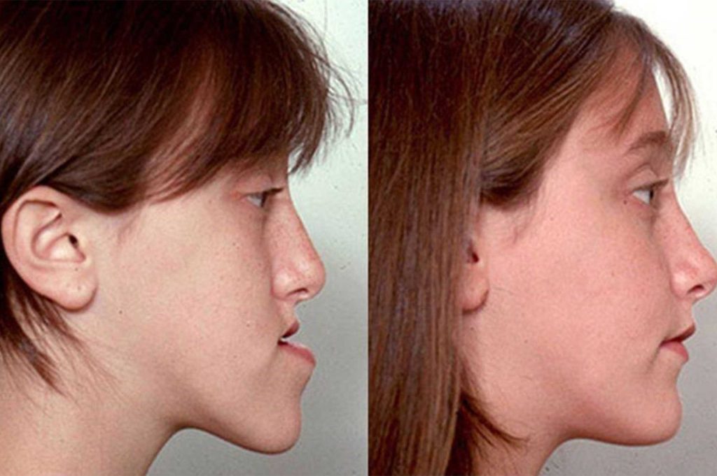 کاشت ابرو چقدر زمان میبرد؟