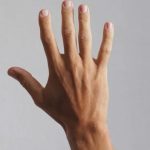 تصویر قبل از درمان