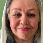 تصویر بعد از درمان