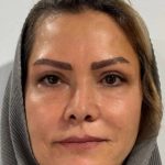 تصویر بعد از درمان