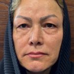 تصویر قبل از درمان