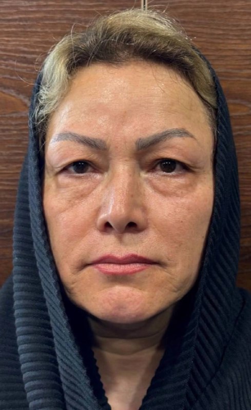 تصویر قبل از درمان