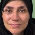 تصویر بعد از درمان