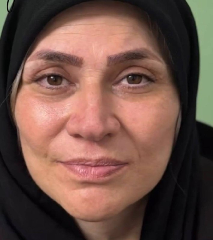 تصویر بعد از درمان