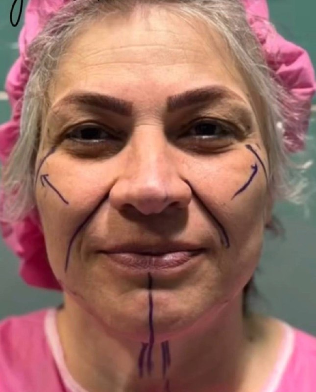 تصویر قبل از درمان