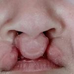 تصویر قبل از درمان