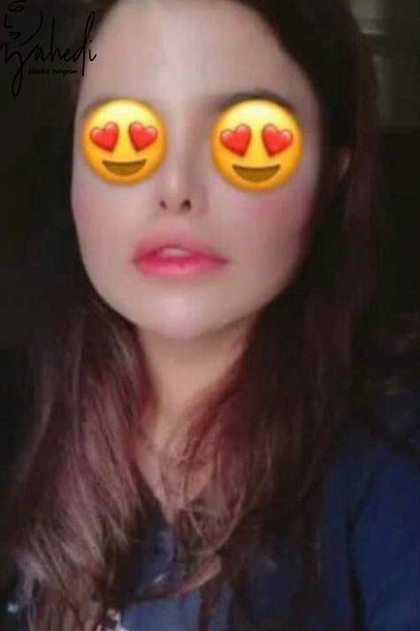 تصویر بعد از درمان