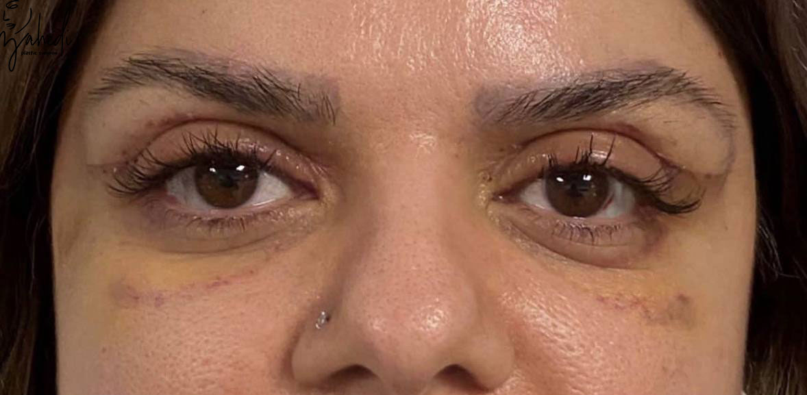 تصویر بعد از درمان