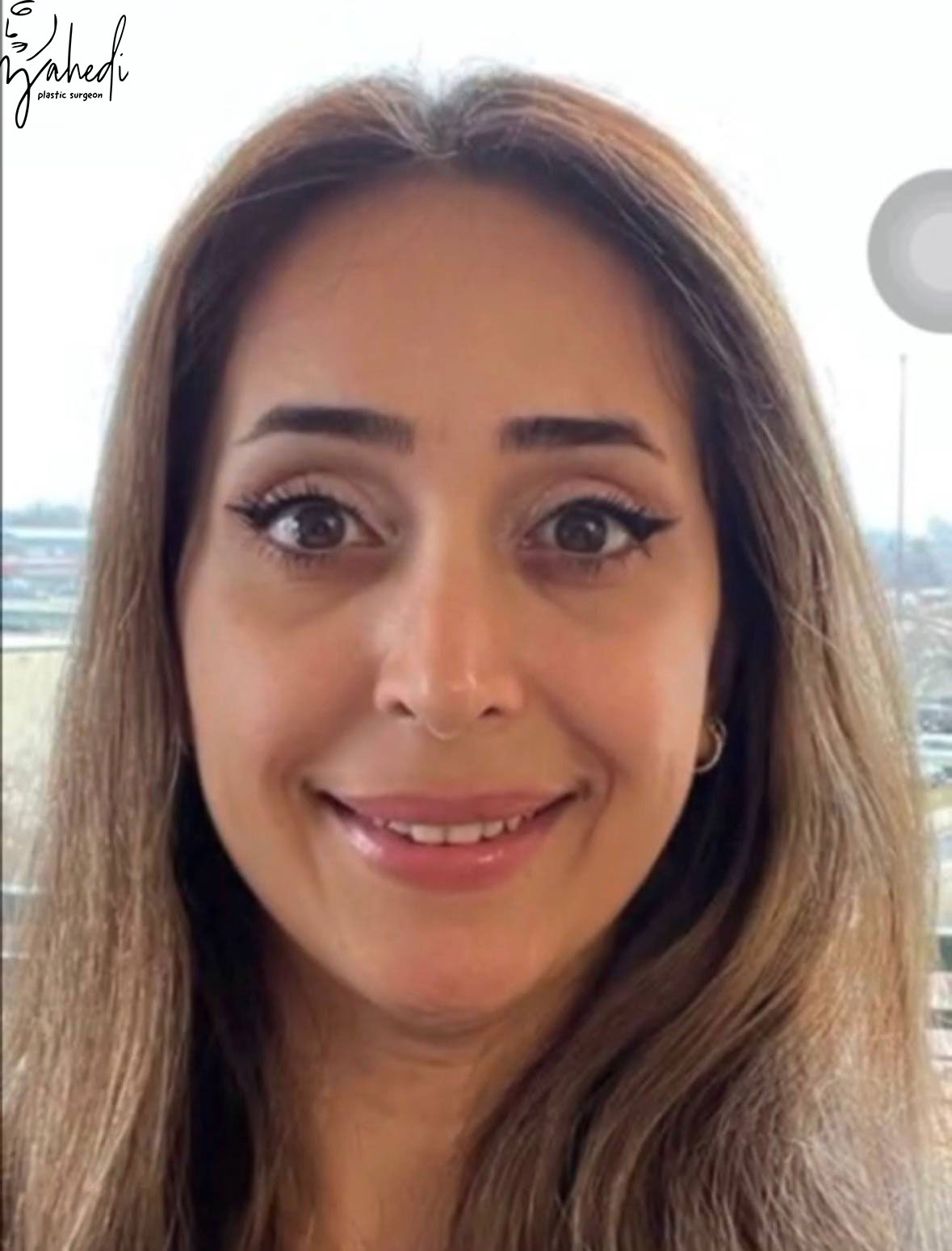 تصویر بعد از درمان