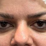 تصویر قبل از درمان