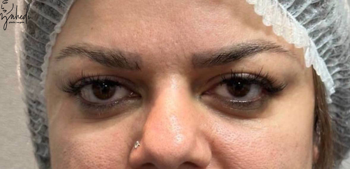 تصویر قبل از درمان