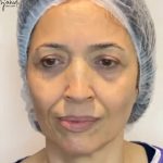 تصویر قبل از درمان