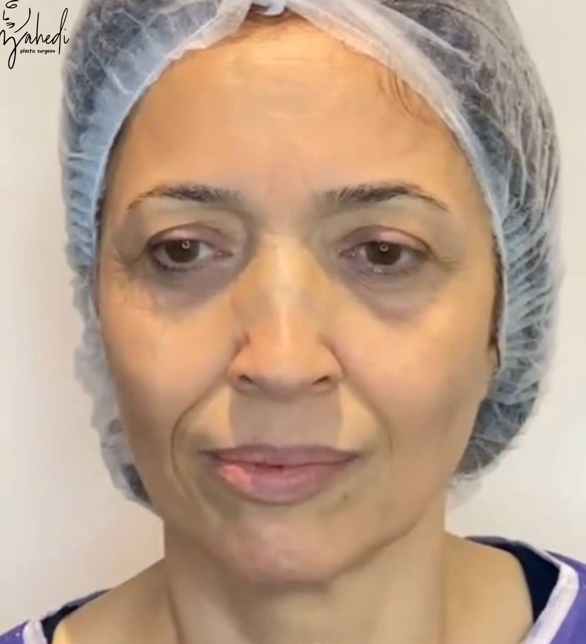 تصویر قبل از درمان