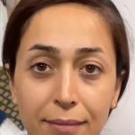 تصویر قبل از درمان