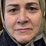 تصویر قبل از درمان