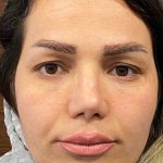 تصویر قبل از درمان