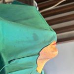 تصویر بعد از درمان