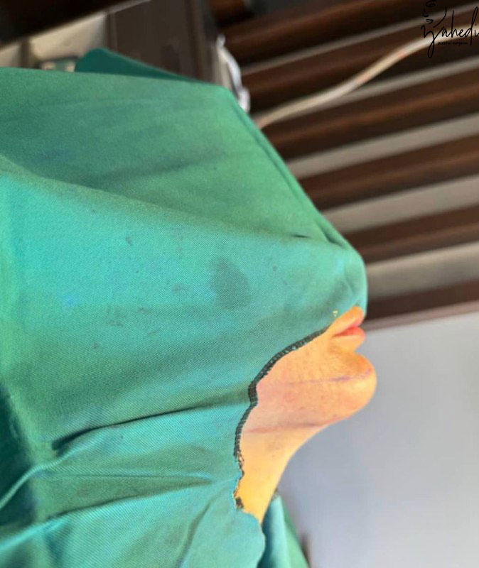 تصویر بعد از درمان