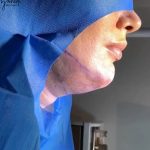 تصویر قبل از درمان