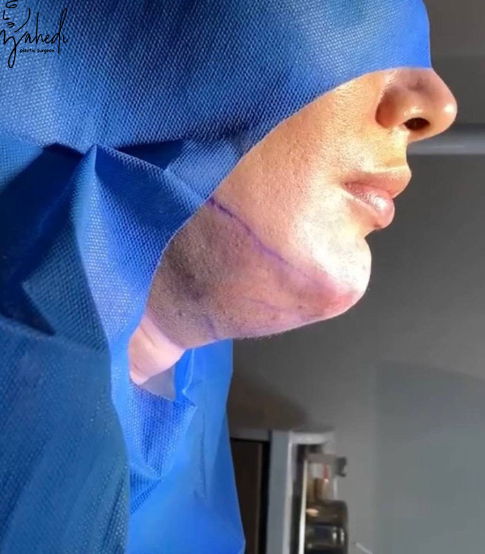 تصویر قبل از درمان