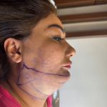 تصویر قبل از درمان