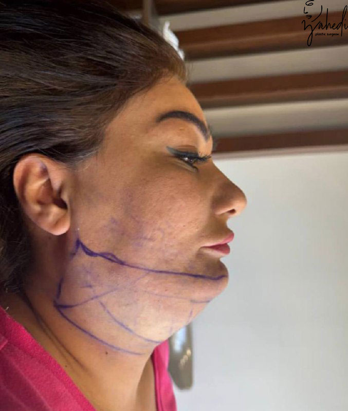 تصویر قبل از درمان