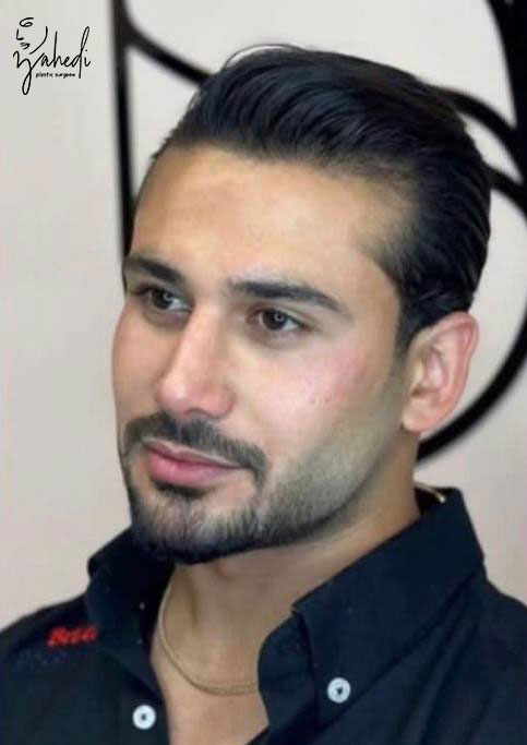 تصویر بعد از درمان