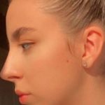 تصویر بعد از درمان