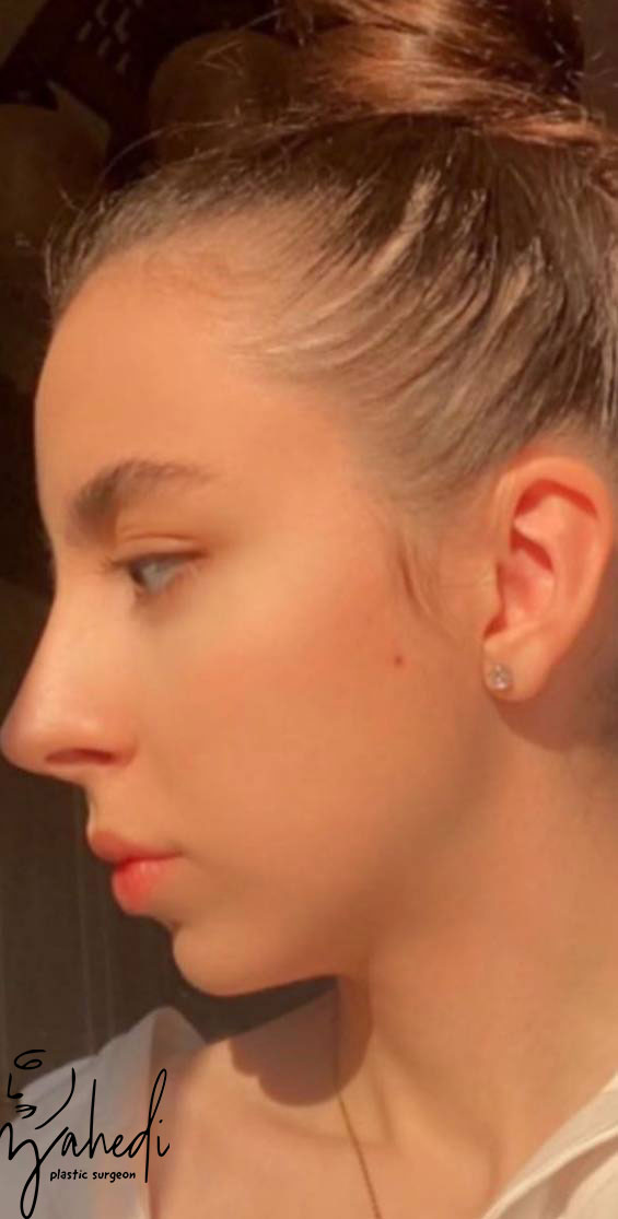 تصویر بعد از درمان