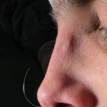 تصویر بعد از درمان