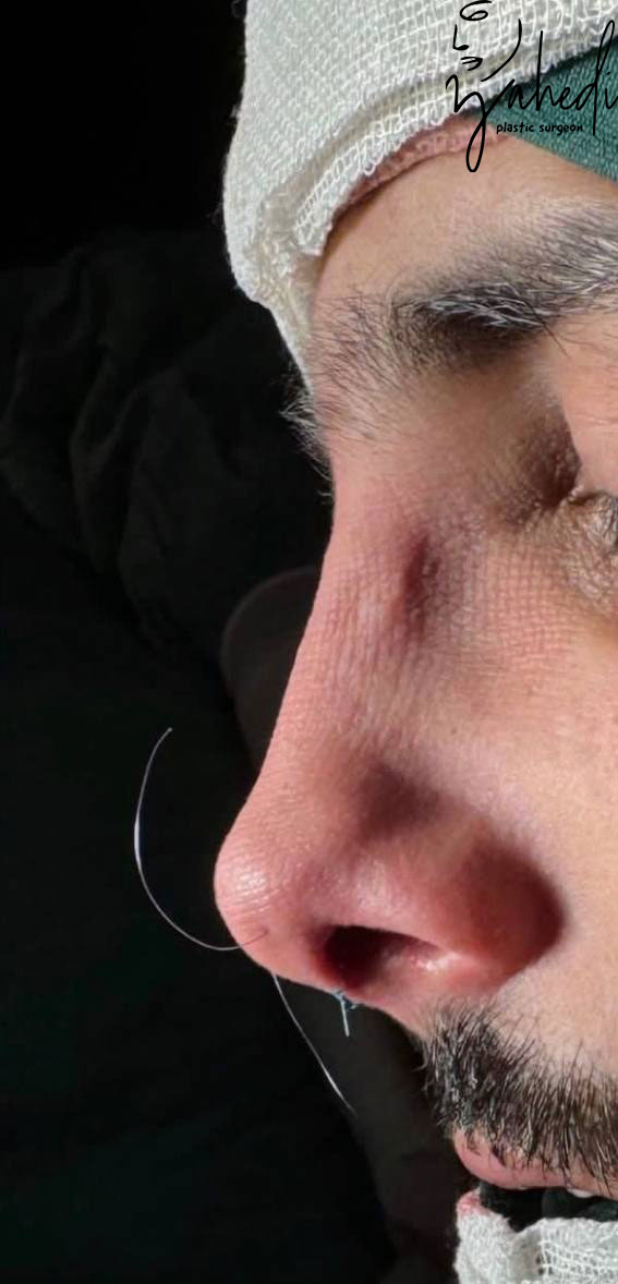 تصویر بعد از درمان