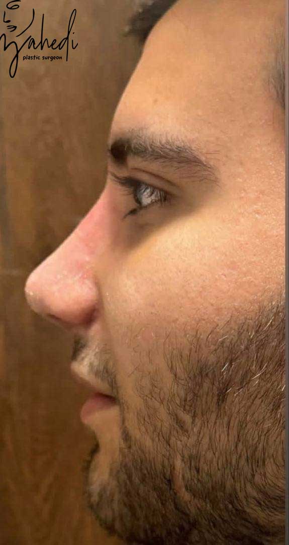 تصویر بعد از درمان