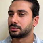 تصویر قبل از درمان