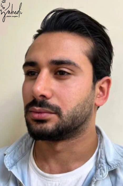 تصویر قبل از درمان