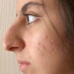 تصویر قبل از درمان