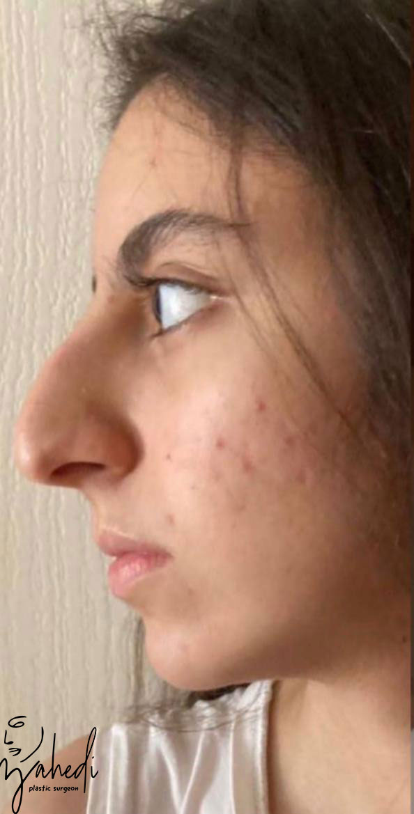 تصویر قبل از درمان