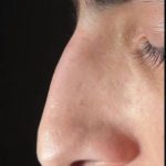 تصویر قبل از درمان