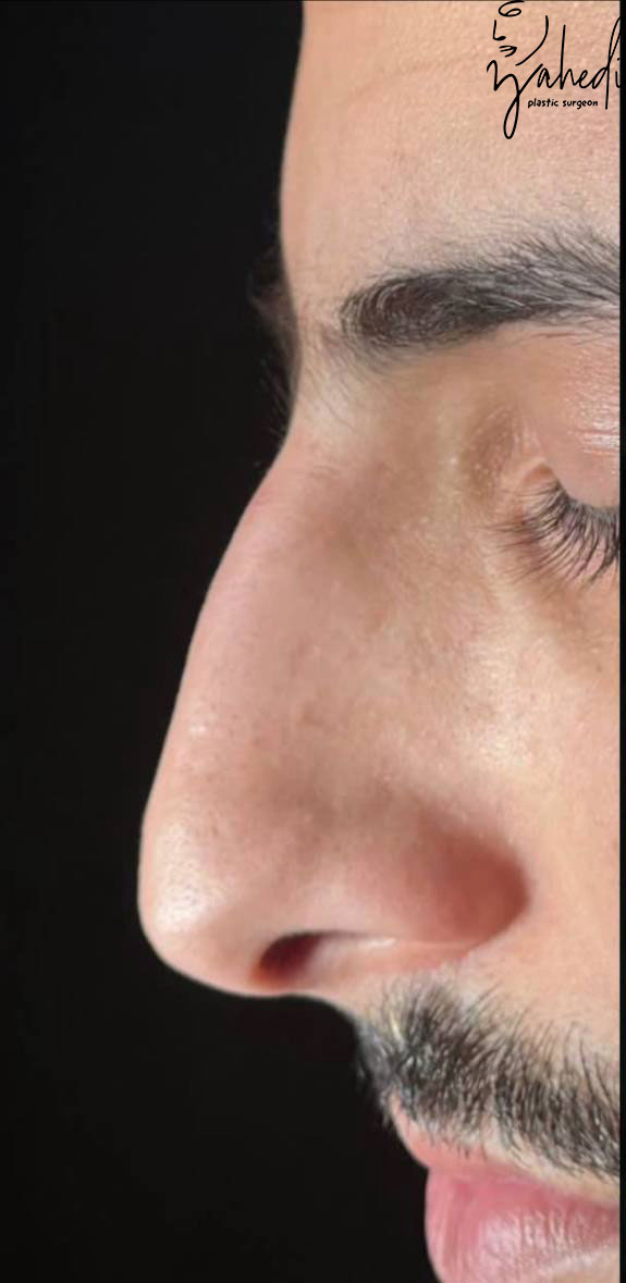 تصویر قبل از درمان