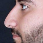 تصویر قبل از درمان