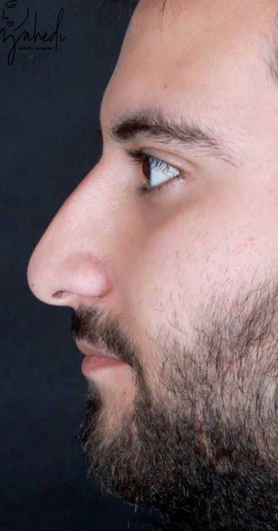 تصویر قبل از درمان