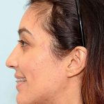 تصویر بعد از درمان