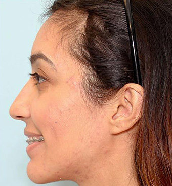 تصویر بعد از درمان