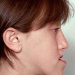 تصویر قبل از درمان