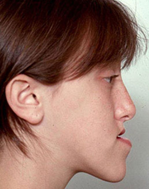 تصویر قبل از درمان