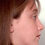 تصویر بعد از درمان