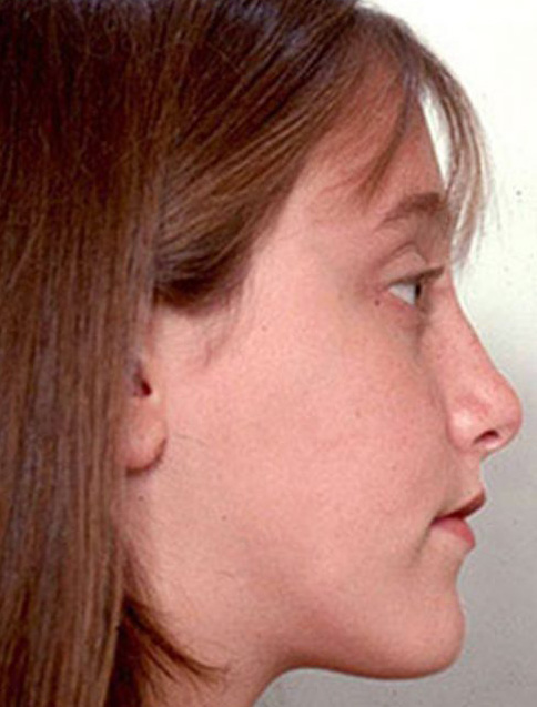 تصویر بعد از درمان