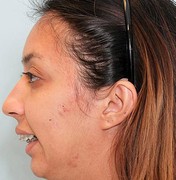 تصویر قبل از درمان