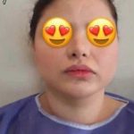 تصویر قبل از درمان