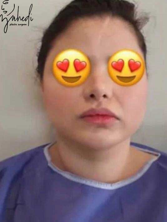 تصویر قبل از درمان