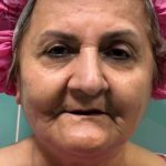 تصویر قبل از درمان